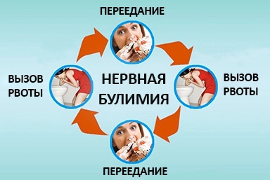 Лечение булимии в Борисове